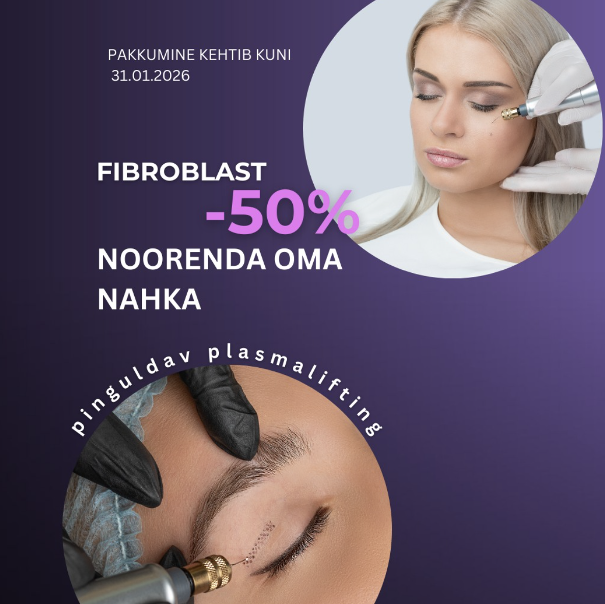 🎁 Kampaania pakkumine: – 50% soodustust !